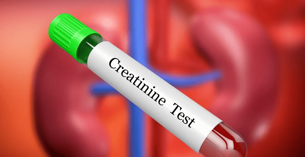 Serum Creatinine