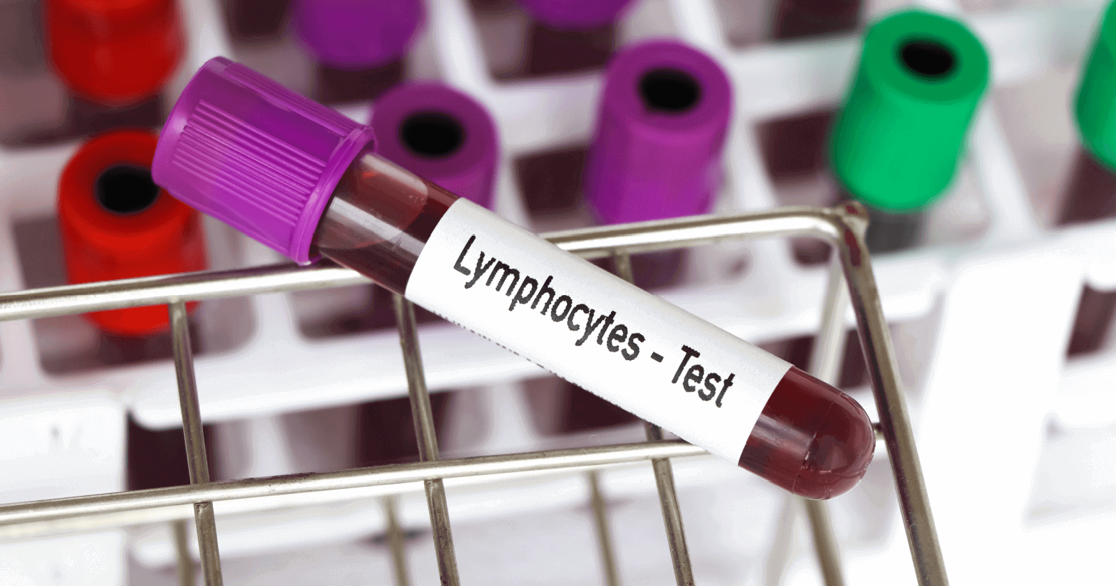 Lymphocyte Count