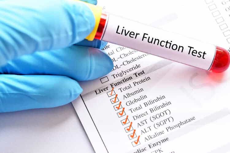 Liver Function Test