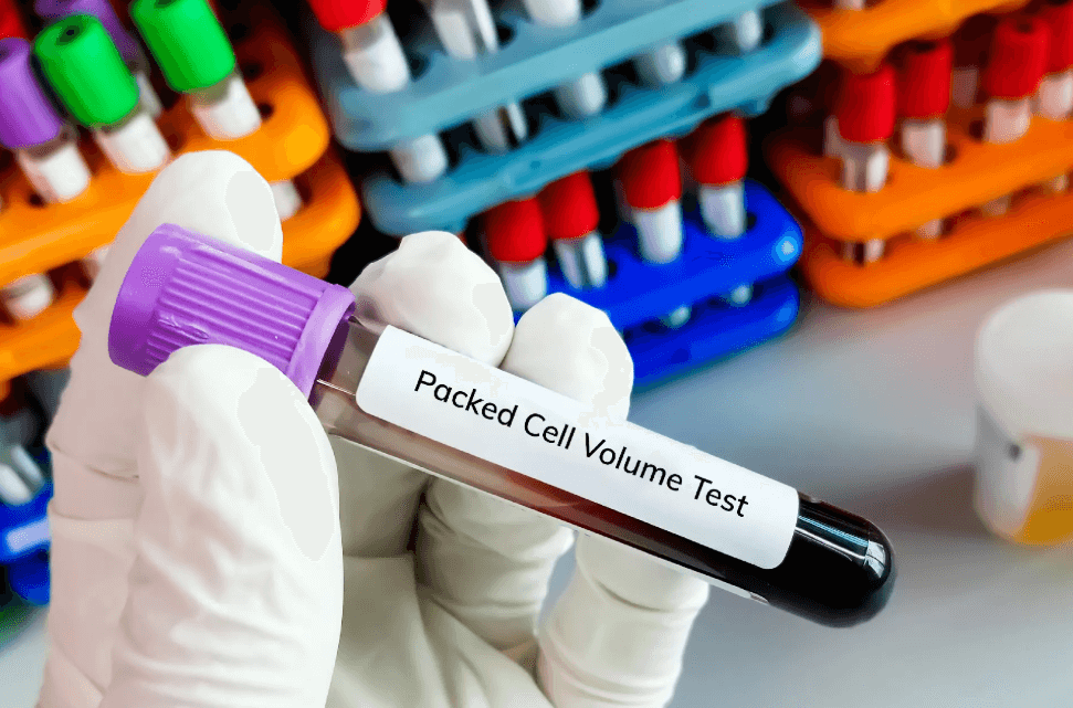 Packed Cell Volume